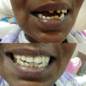 Dr Shruti Tongay Advanced Dental Clinic